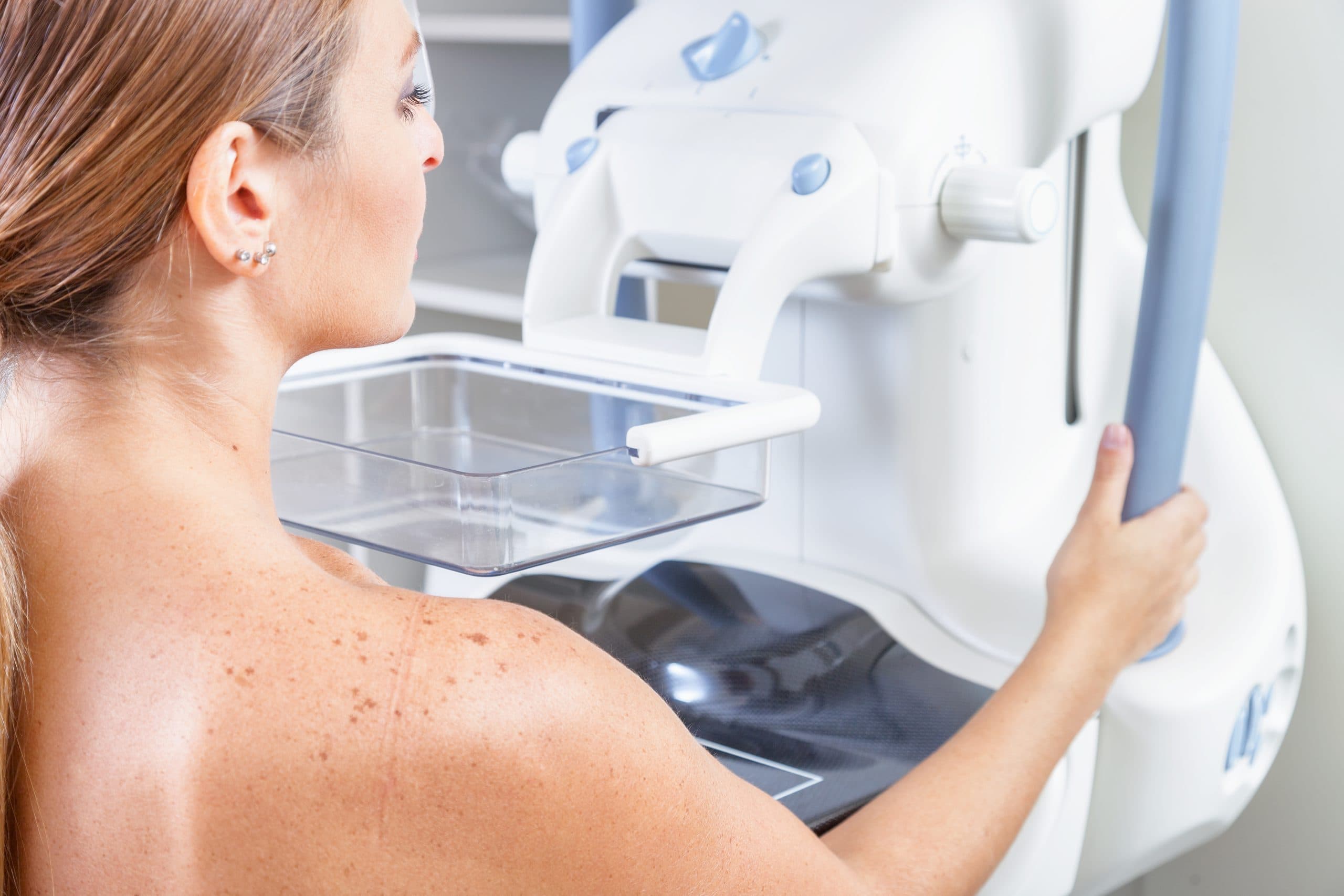 Qual a diferença entre mamografia diagnóstica e mamografia de rastreamento?