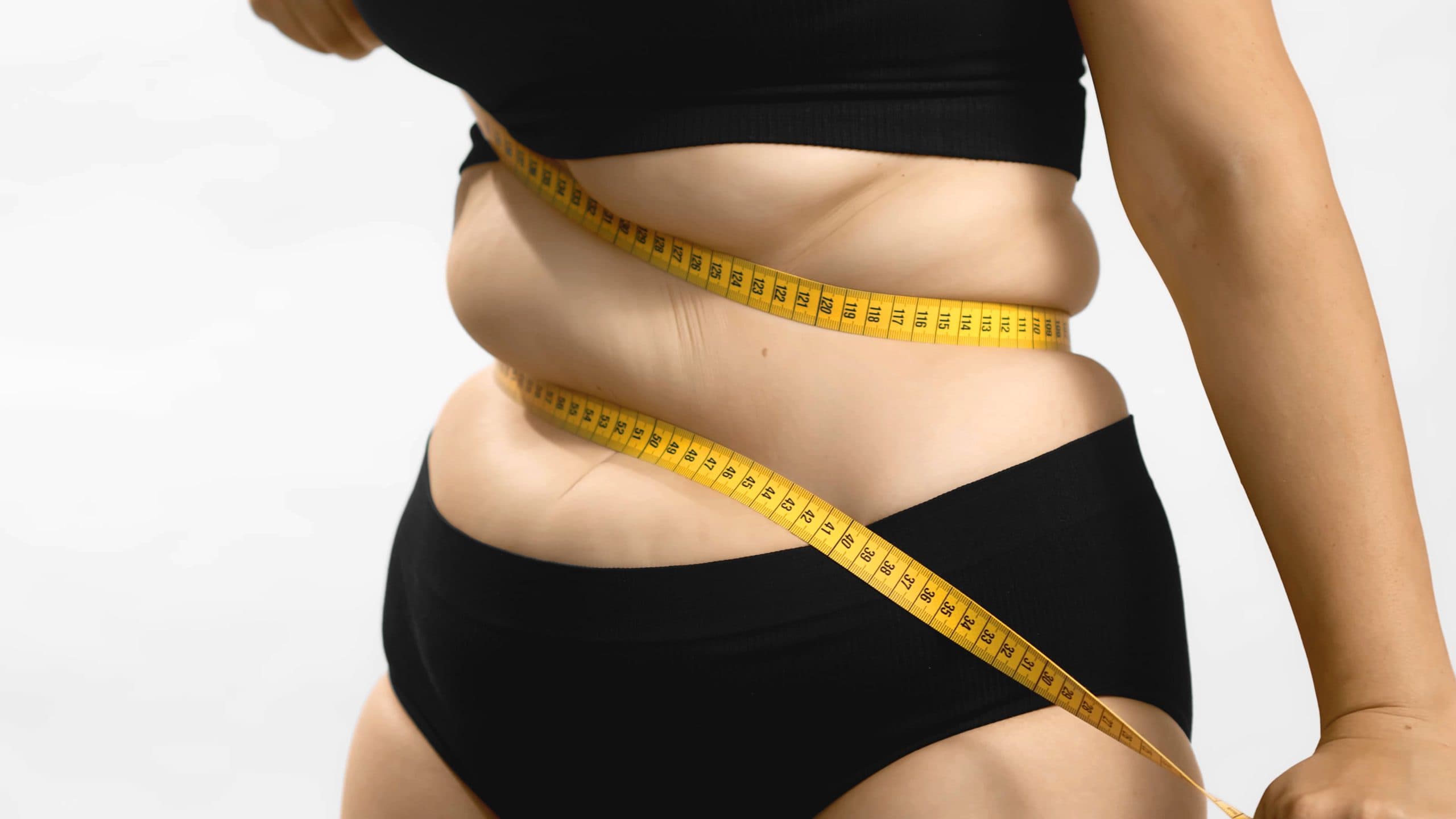 Mês de combate à obesidade: o que é a doença e como cuidar