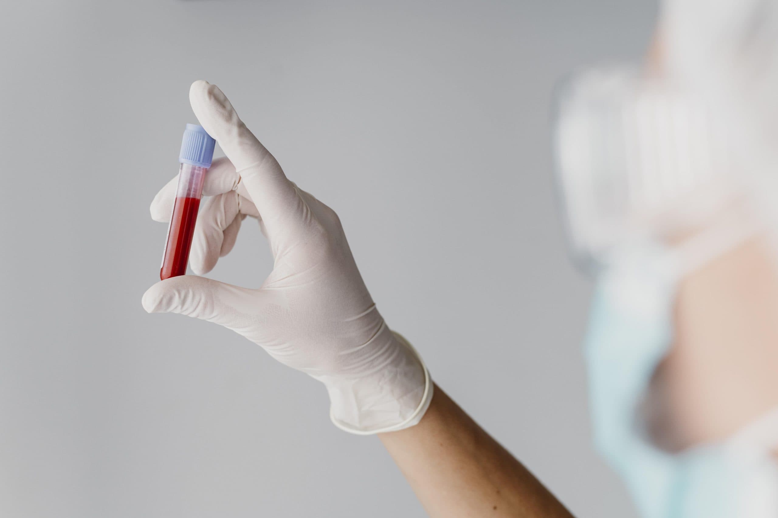 Hemofilia é hereditária e principal sintoma é o sangramento