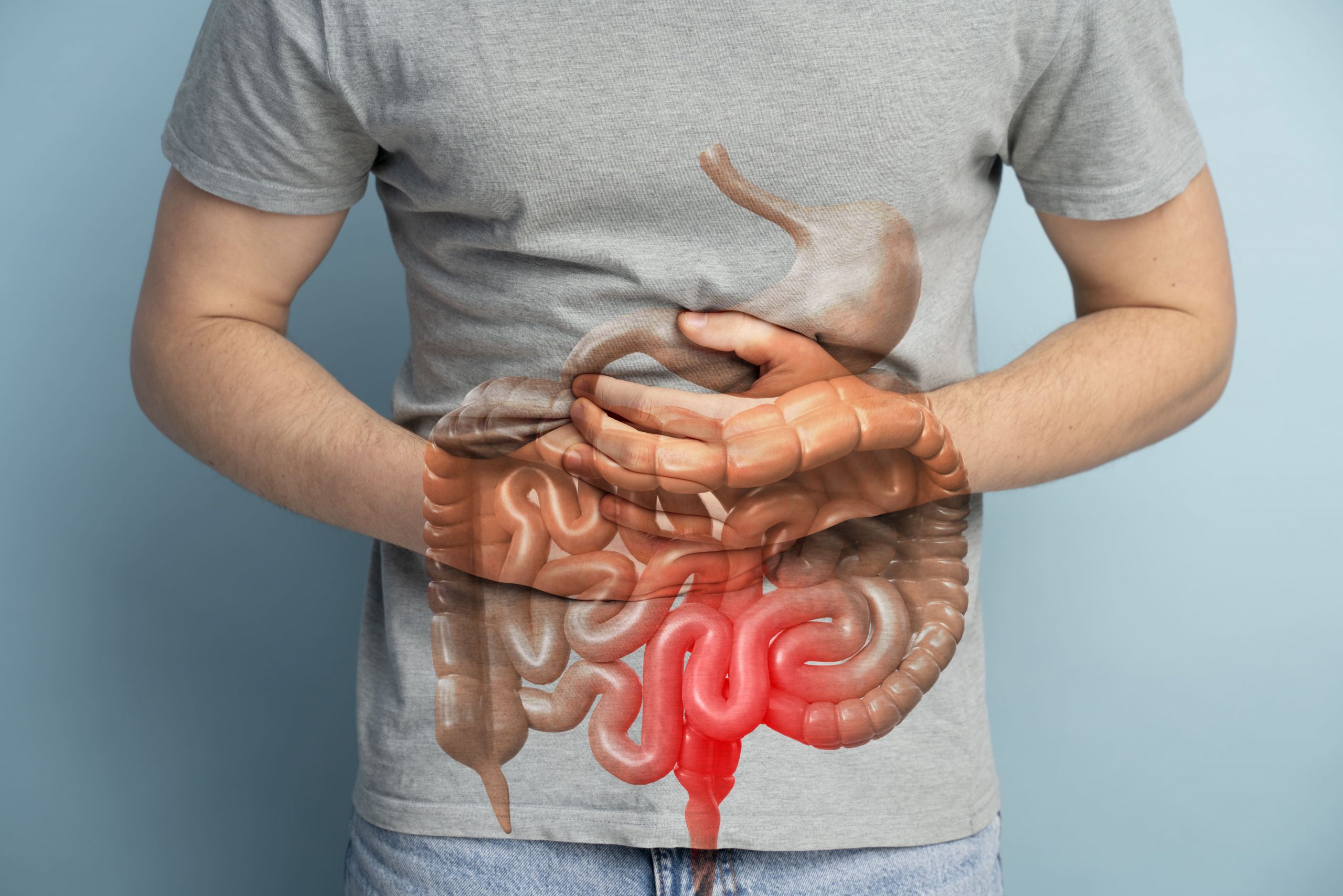 Março Azul: conscientização e prevenção do câncer de intestino